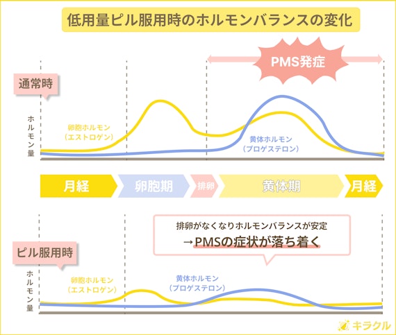 低用量ピルでPMSへの効果が期待できる理由